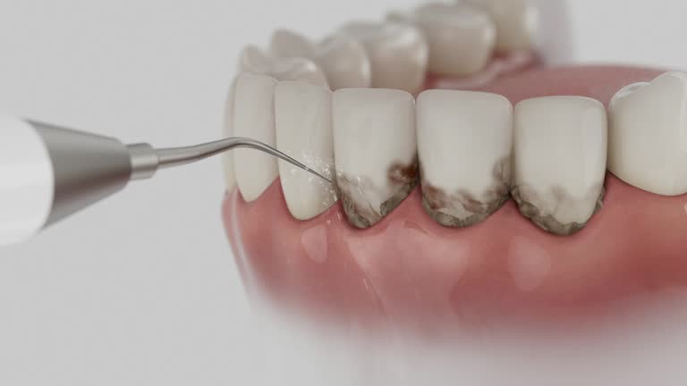 Reliable Dental Implants contractor in Windsor, CO by Smile Center Dentistry